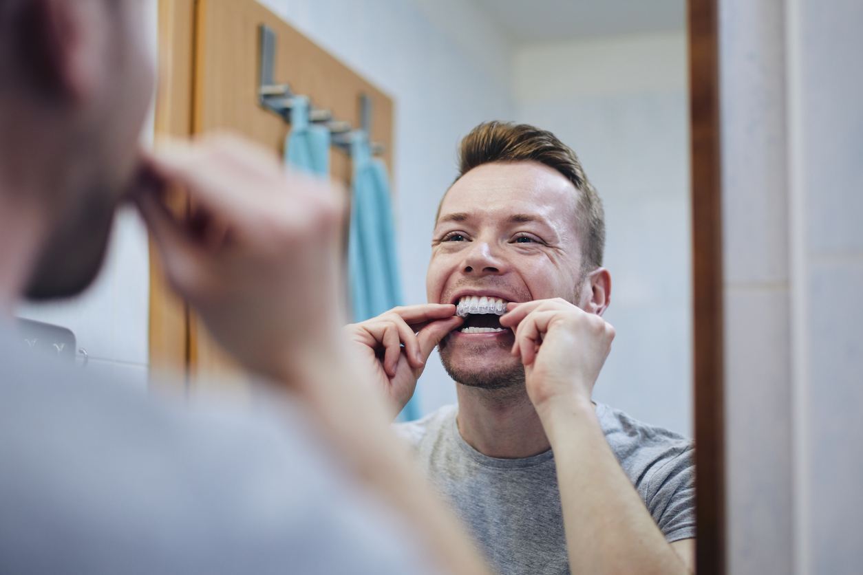 The Dangers of Do It Yourself Aligners