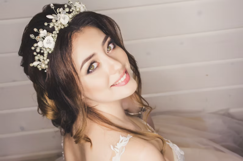 Picture-Perfect Smiles: The Benefits of Getting Braces Before Your Wedding